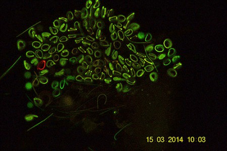 Spermatogenesi in lombricus - Si noti l'eccezionale differenziazione realizzata dal metodo di colorazione adottato - DiBR FITC